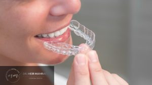 יישור שיניים שקוף - תמונה ראשית - ד״ר מאיר ממרייב