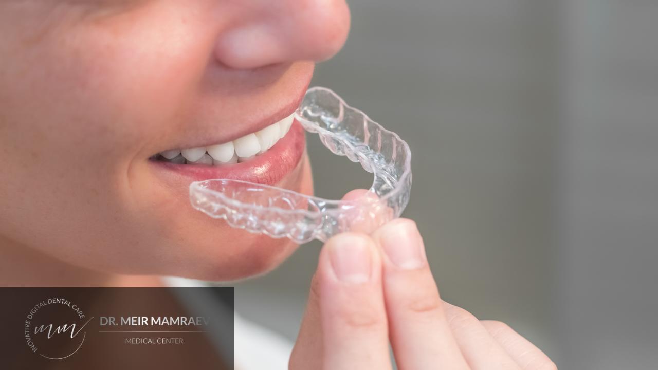 יישור שיניים שקוף - תמונה ראשית - ד״ר מאיר ממרייב