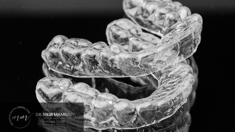 פלטות שקופות ליישור שיניים - תמונה ראשית - ד״ר מאיר ממרייב