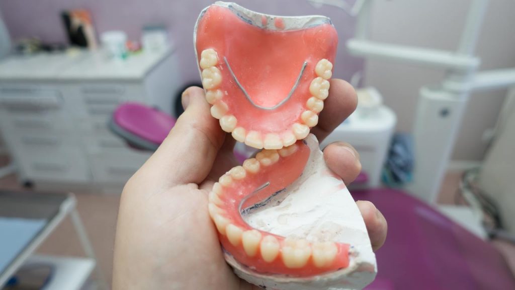 השלמת שיניים - תמונה להמחשה