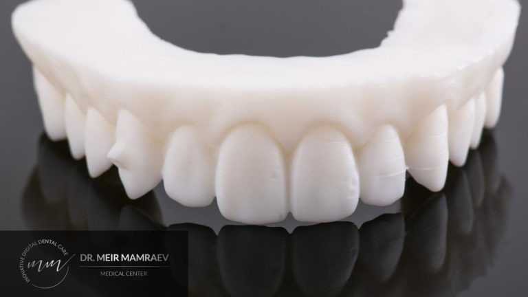 כתרים לשיניים קדמיות - תמונה ראשית - ד״ר מאיר ממרייב