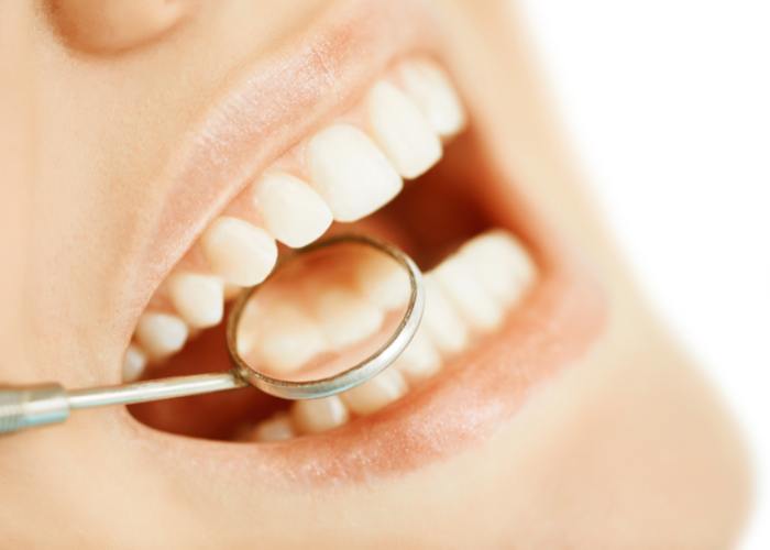 חשיבות של שמירה על היגיינת הפה אחרי טיפול אול אין פור