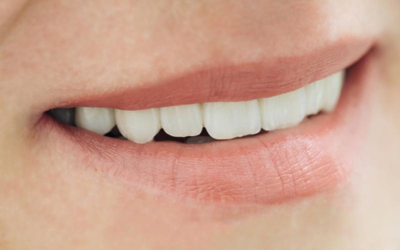 תמונה להמחשה של חיוך עם שיניים עם כתר זירוקניה