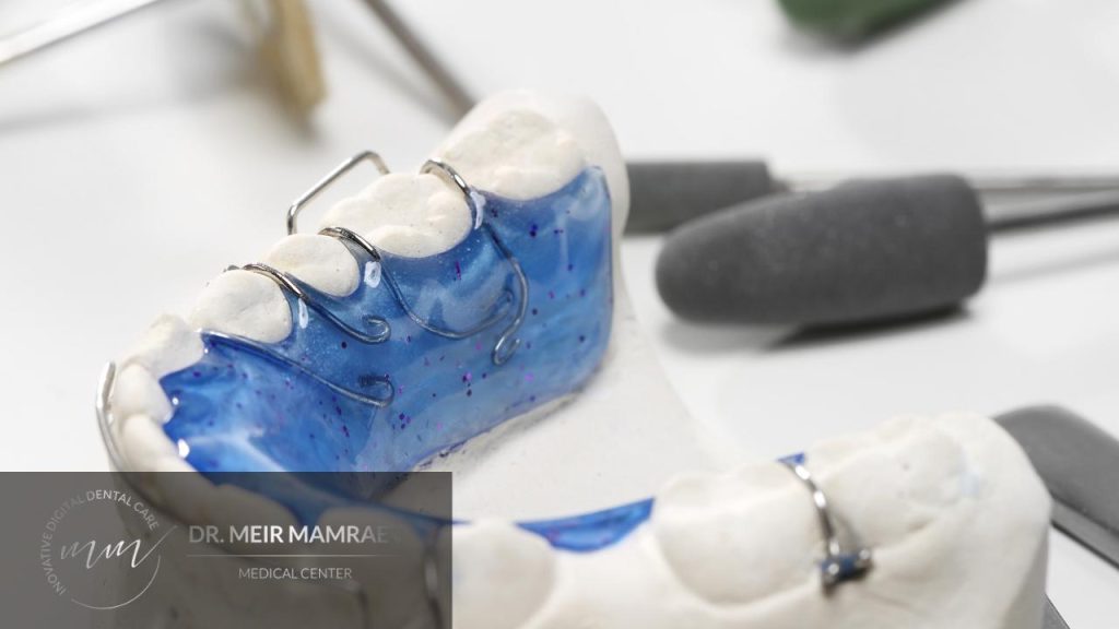 יישור שיניים פנימי - ד״ר ממרייב