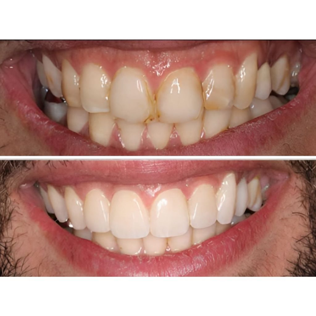 טיפול רפואי מקצועי לתיקון פגמים בשיניים