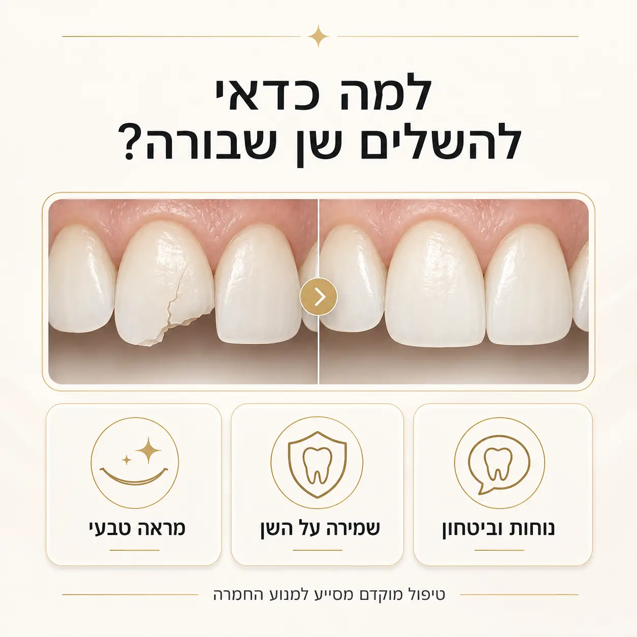 השלמת שן קדמית | אינפוגרפיקה