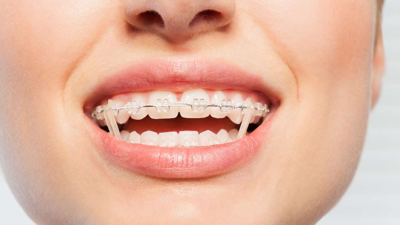 כמה זמן צריך ללבוש את הגומיות ביוםר תמונה ראשית דר מאיר ממרייב