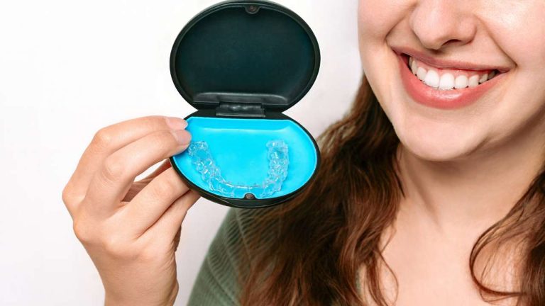 ריטיינר אחרי יישור שיניים תמונה ראשית דר מאיר ממרייב