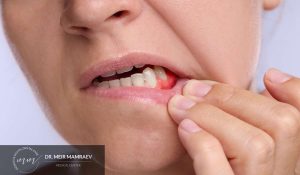 אבצס בחניכיים