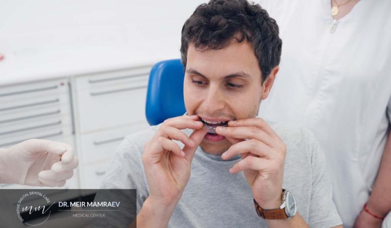 אינויזליין או פתרון אחר איך יודעים אם קשתיות שקופות הן באמת הבחירה הנכונה במקרה שלכם